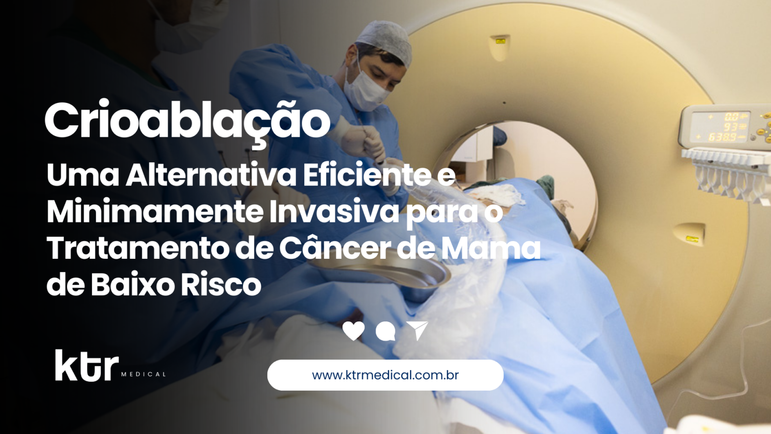 Médicos realizando crioablação para tratar câncer de mama