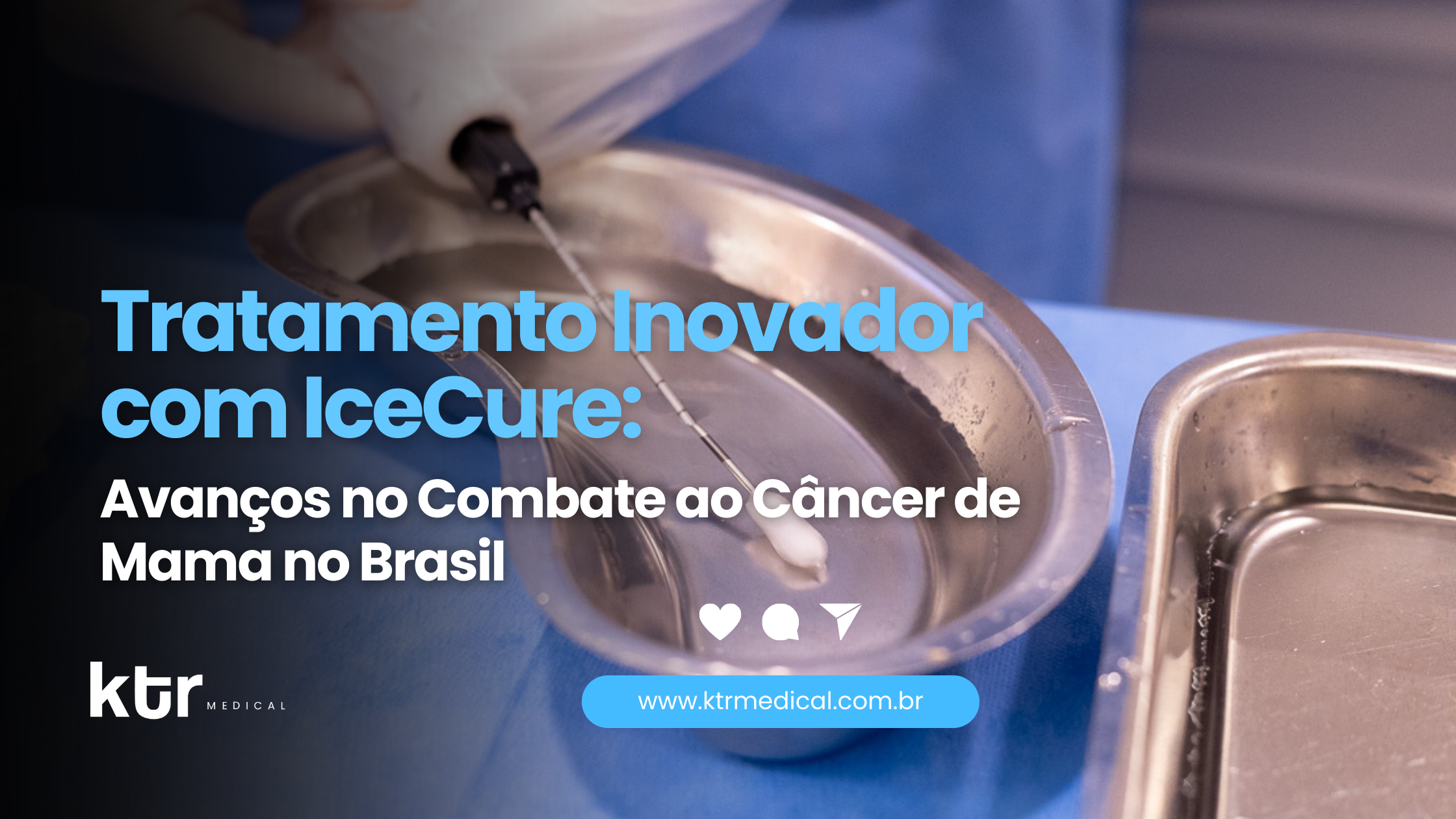 Descubra como a crioablação com IceCure está transformando o tratamento do câncer de mama no Brasil, oferecendo inovação e mais qualidade de vida.